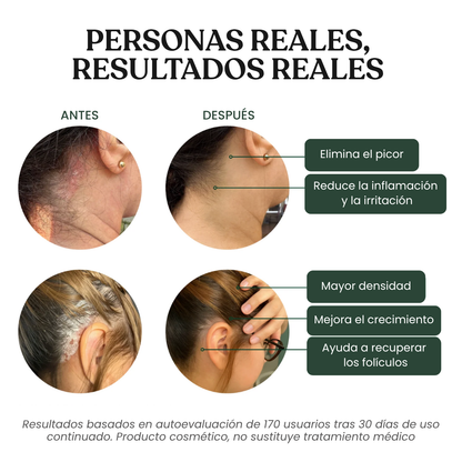 Exfoliante Capilar Natural Belvarn