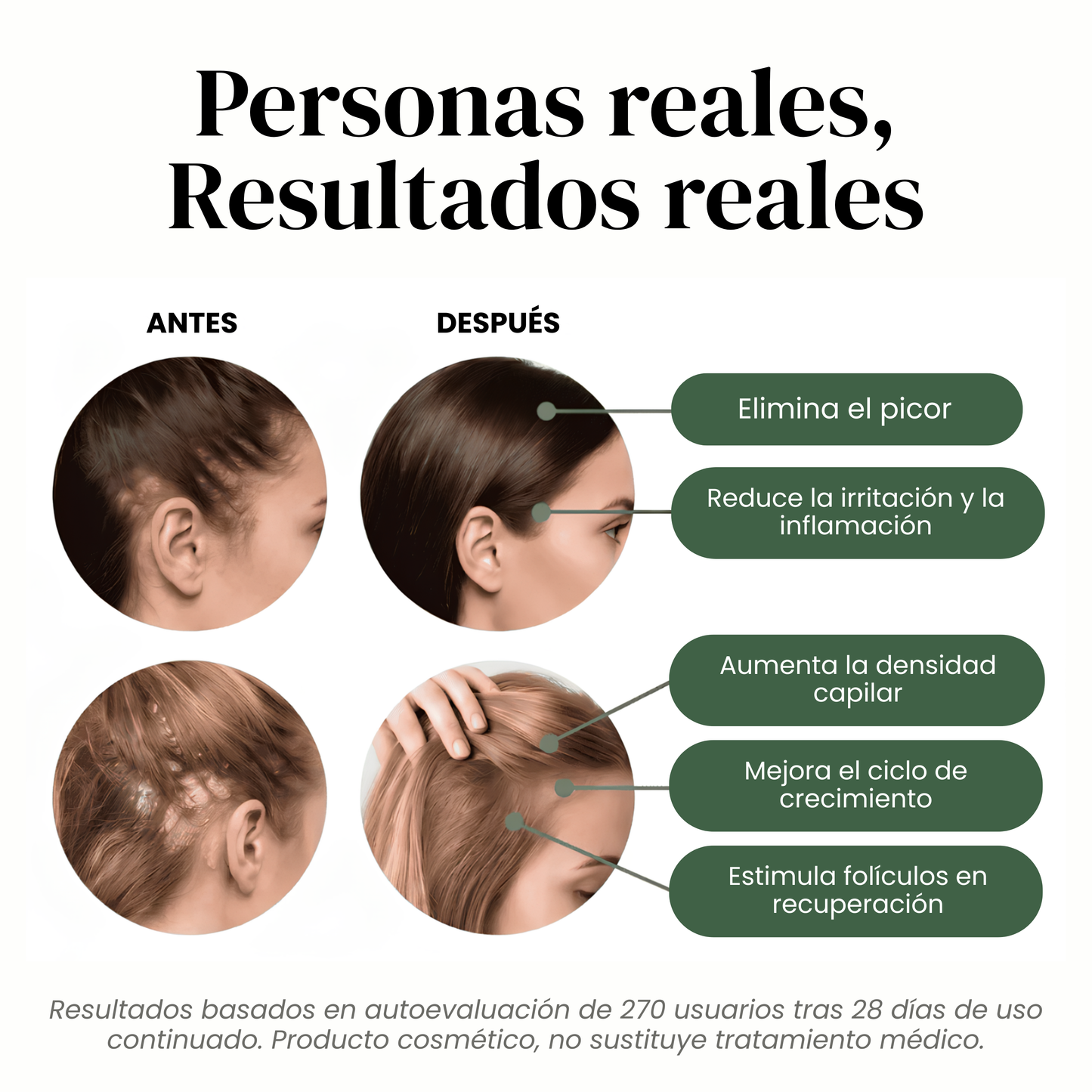 Barra para el Cuidado del Cuero Cabelludo